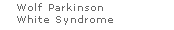 Wolf Parkinson White Syndrome